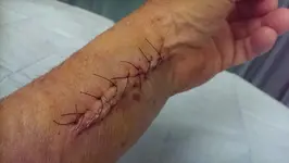 stitches.webp stitches.webp